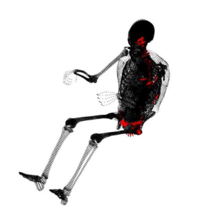 zones à risque de blessure élevé dans le cas du choc latéral surlignées en rouge sur le squelette représenté
